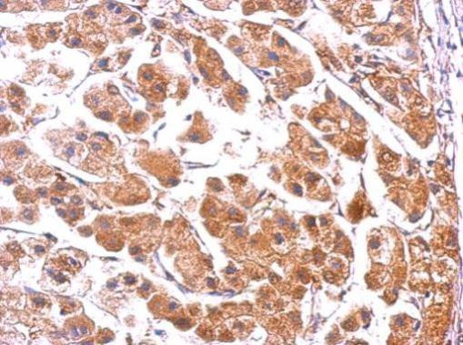 PUMA alpha Antibody in Immunohistochemistry (Paraffin) (IHC (P))