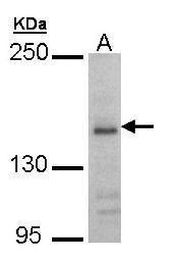 NMDAR2B Antibody in Western Blot (WB)