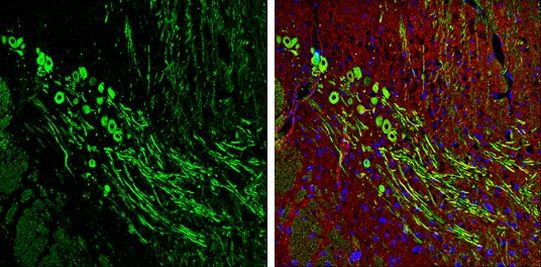 NF-H Antibody in Immunohistochemistry (Frozen) (IHC (F))