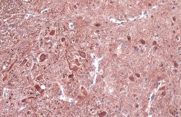 NF-H Antibody in Immunohistochemistry (Paraffin) (IHC (P))