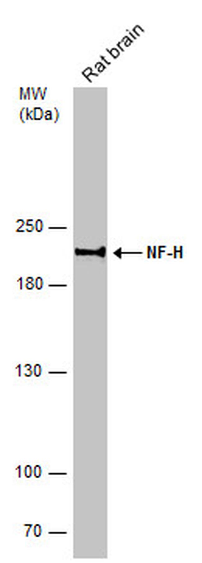 NF-H Antibody in Western Blot (WB)