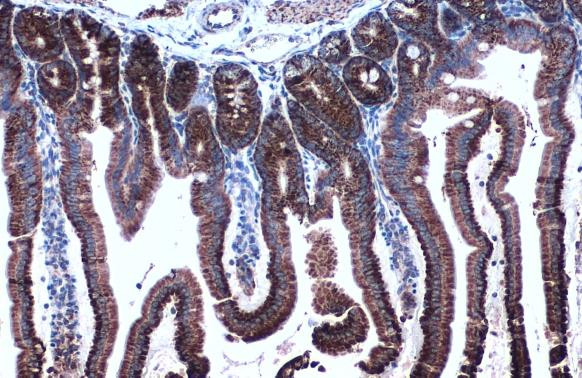 HSP60 Antibody in Immunohistochemistry (Paraffin) (IHC (P))