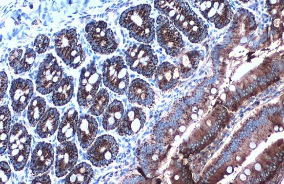 HSP60 Antibody in Immunohistochemistry (Paraffin) (IHC (P))