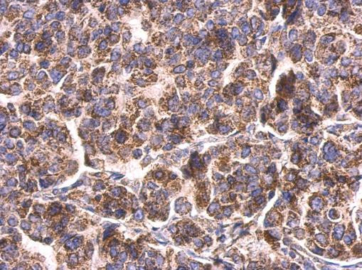 HSP60 Antibody in Immunohistochemistry (Paraffin) (IHC (P))