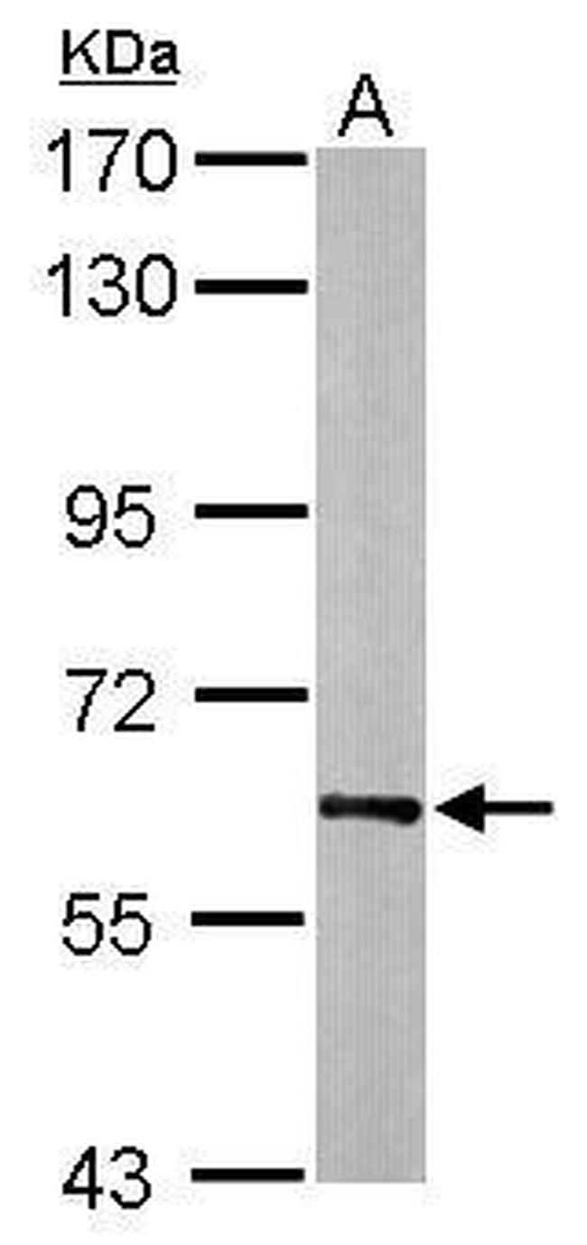 HSP60 Antibody in Western Blot (WB)