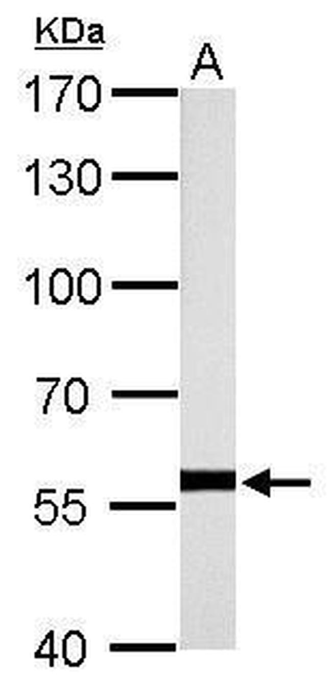 HSP60 Antibody in Western Blot (WB)