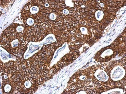 Cytokeratin 8 Antibody in Immunohistochemistry (Paraffin) (IHC (P))