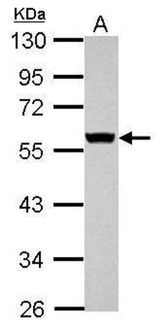 Cytokeratin 8 Antibody in Western Blot (WB)