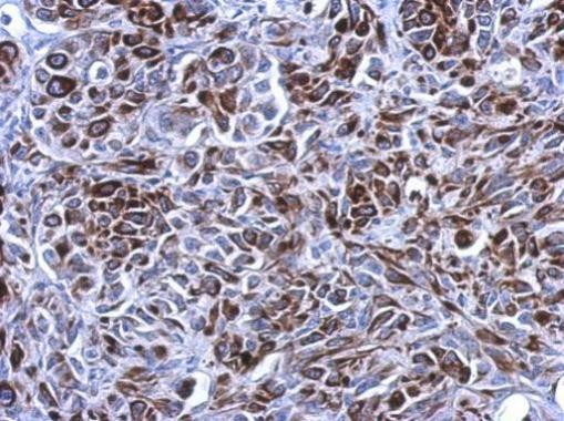 Cytokeratin 7 Antibody in Immunohistochemistry (Paraffin) (IHC (P))