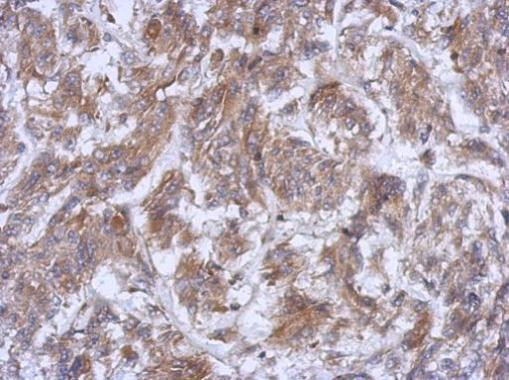 ATG16L1 Antibody in Immunohistochemistry (Paraffin) (IHC (P))