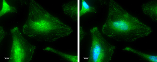 p38 MAPK alpha Antibody in Immunocytochemistry (ICC/IF)