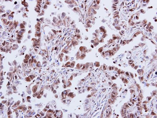 p38 MAPK alpha Antibody in Immunohistochemistry (Paraffin) (IHC (P))