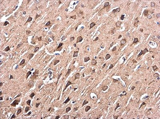 p38 MAPK alpha Antibody in Immunohistochemistry (Paraffin) (IHC (P))