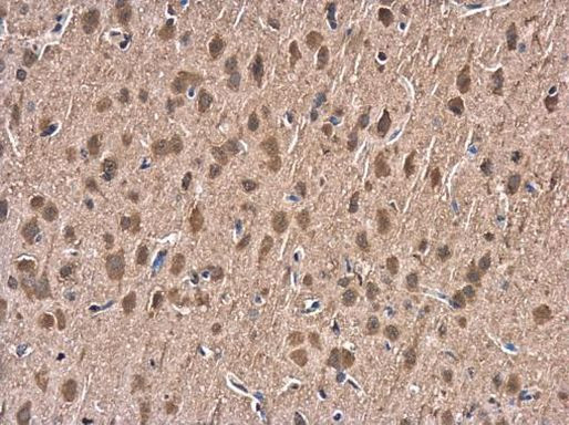 HSPA1A Antibody in Immunohistochemistry (Paraffin) (IHC (P))