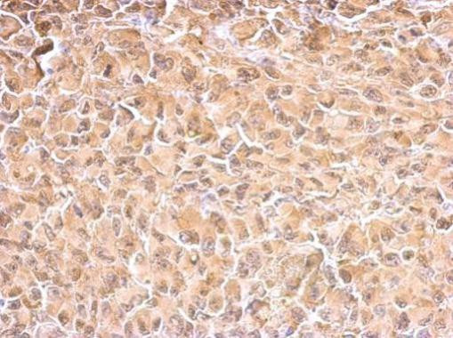 HSPA1A Antibody in Immunohistochemistry (Paraffin) (IHC (P))