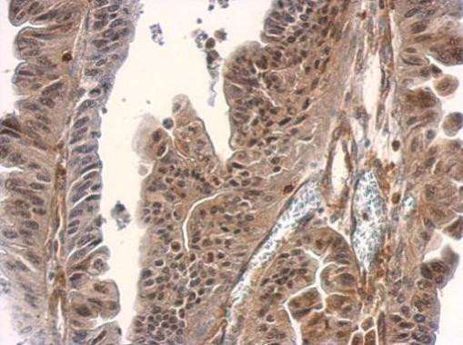 SMAD3 Antibody in Immunohistochemistry (Paraffin) (IHC (P))