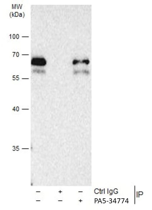 SMAD3 Antibody in Immunoprecipitation (IP)