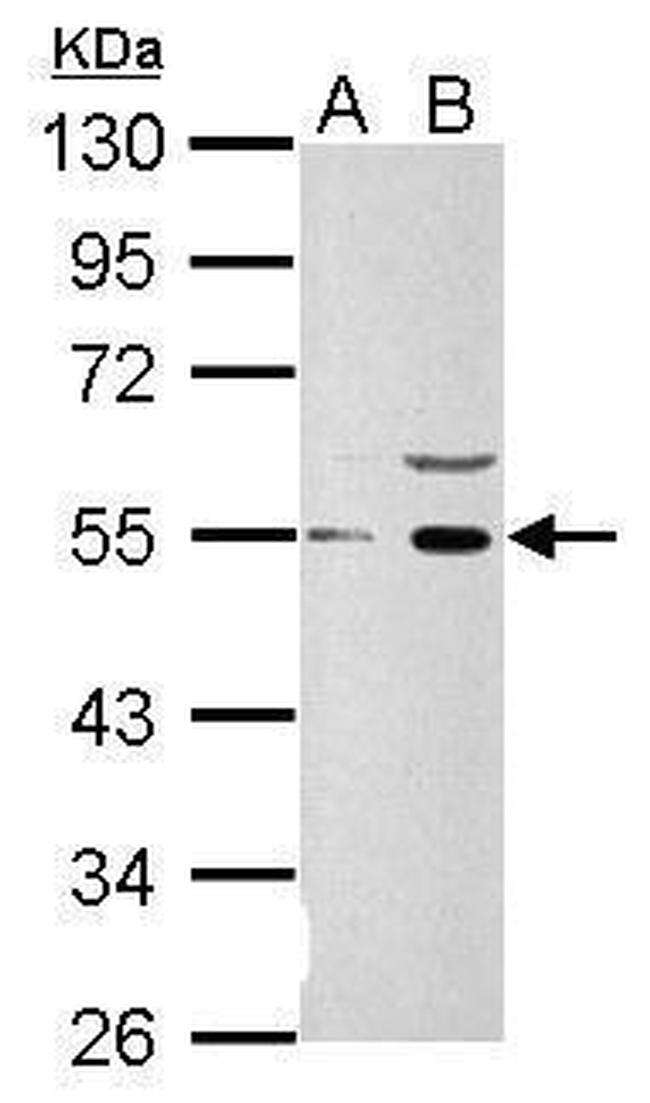 WNT1 Antibody in Western Blot (WB)