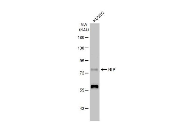 RIP1 Antibody in Western Blot (WB)