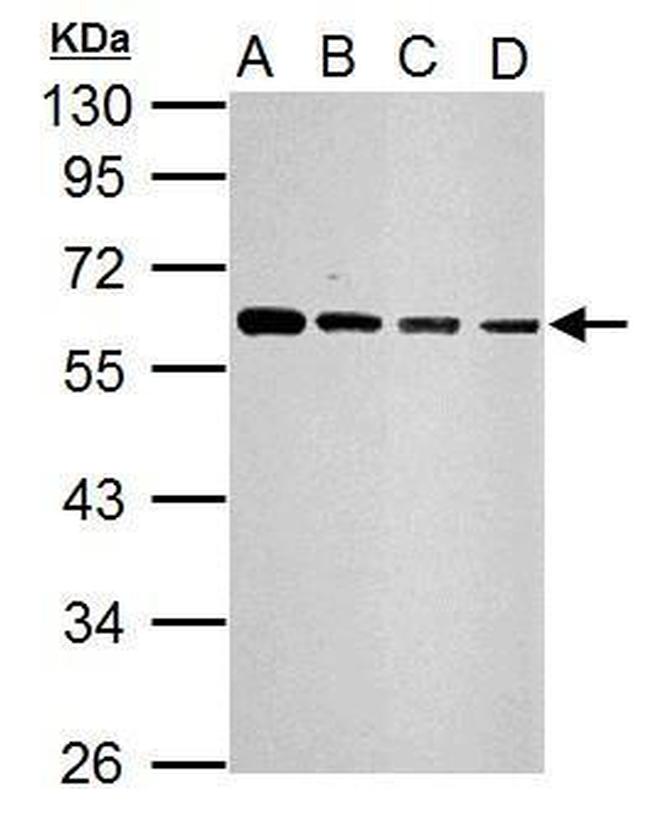 SQSTM1 Antibody in Western Blot (WB)