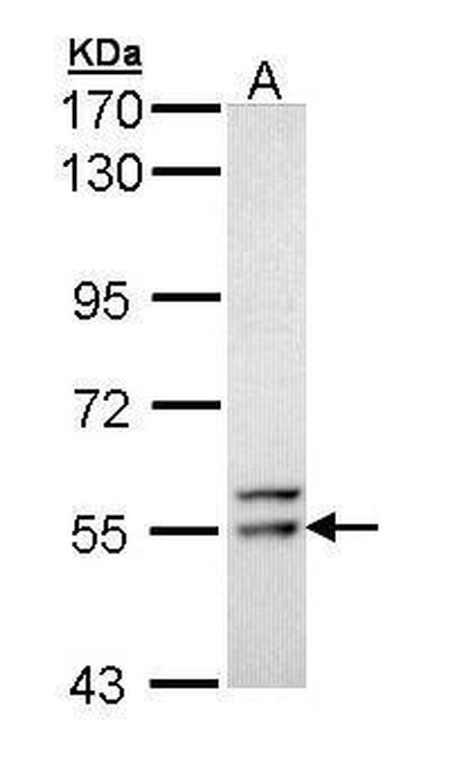 FRK Antibody in Western Blot (WB)