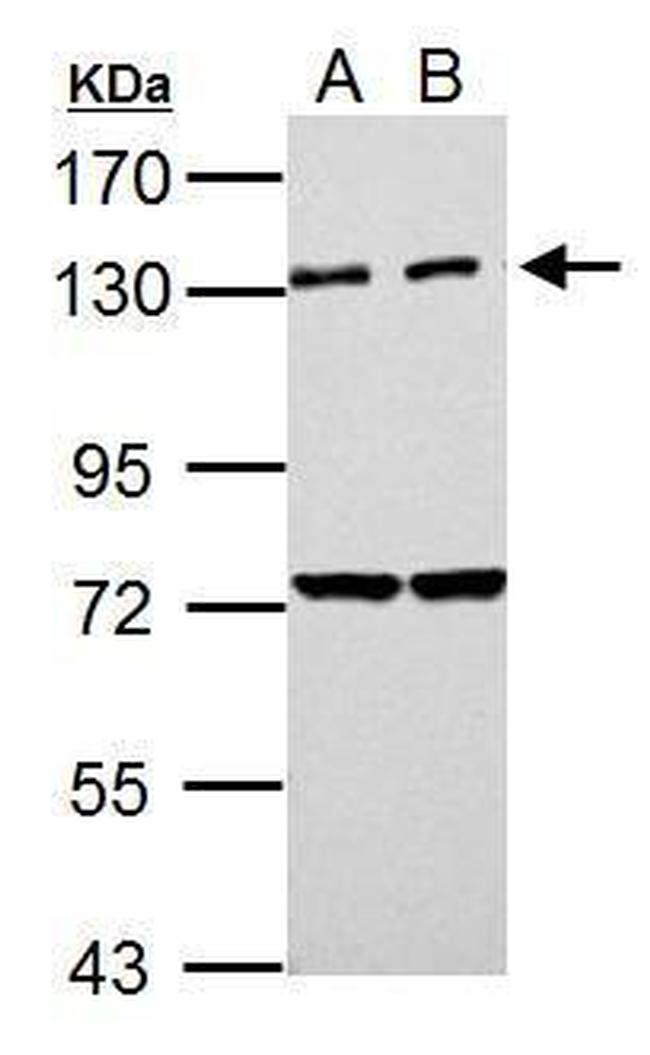 PKN2 Antibody in Western Blot (WB)