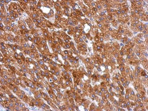 Calreticulin Antibody in Immunohistochemistry (Paraffin) (IHC (P))