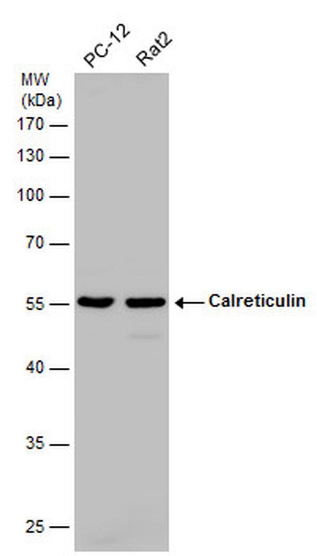 Calreticulin Antibody in Western Blot (WB)