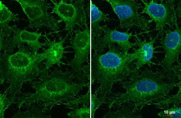 Collagen III Antibody in Immunocytochemistry (ICC/IF)