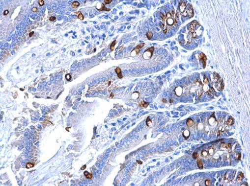 Collagen III Antibody in Immunohistochemistry (Paraffin) (IHC (P))