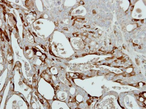 Collagen III Antibody in Immunohistochemistry (Paraffin) (IHC (P))