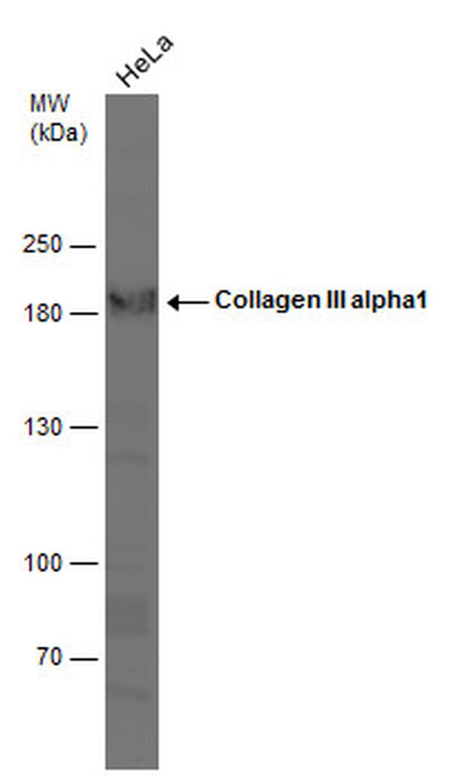 Collagen III Antibody in Western Blot (WB)