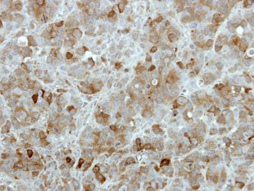 TBCK Antibody in Immunohistochemistry (Paraffin) (IHC (P))