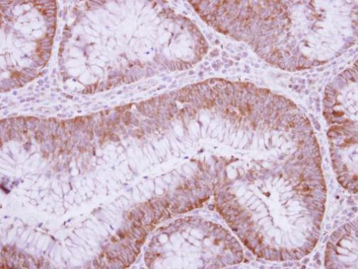 Urokinase Antibody in Immunohistochemistry (Paraffin) (IHC (P))