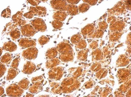 IL-21 Antibody in Immunohistochemistry (Paraffin) (IHC (P))