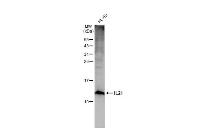 IL-21 Antibody in Western Blot (WB)