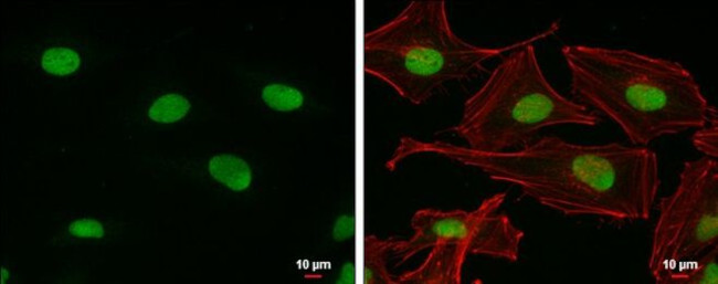 PARP1 Antibody in Immunocytochemistry (ICC/IF)