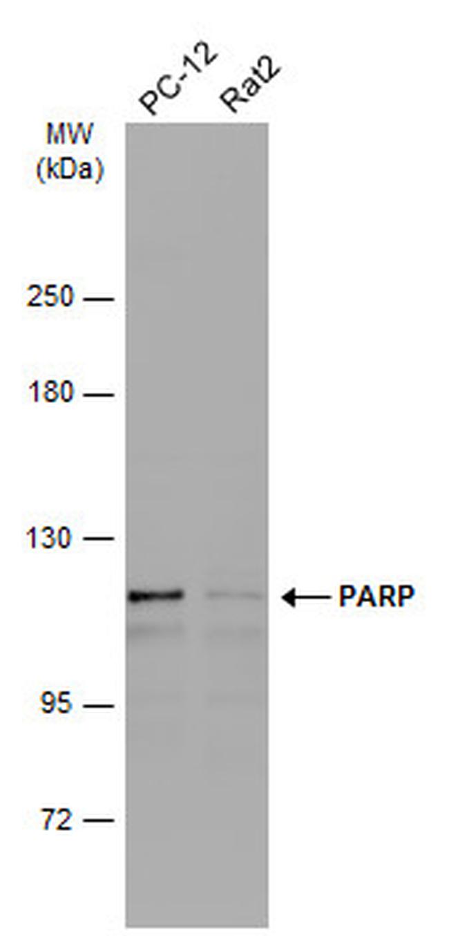 PARP1 Antibody in Western Blot (WB)