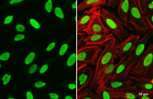 PARP1 Antibody in Immunocytochemistry (ICC/IF)