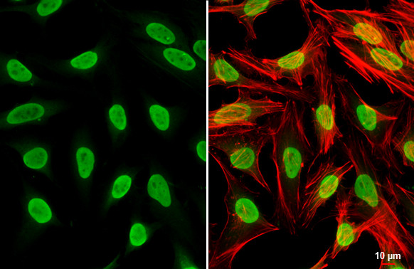 PARP1 Antibody in Immunocytochemistry (ICC/IF)