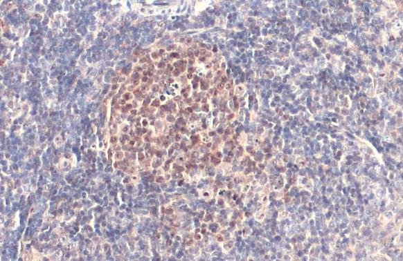 PARP1 Antibody in Immunohistochemistry (Paraffin) (IHC (P))