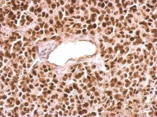 PARP1 Antibody in Immunohistochemistry (Paraffin) (IHC (P))