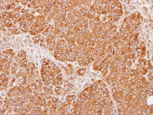 Calnexin Antibody in Immunohistochemistry (Paraffin) (IHC (P))