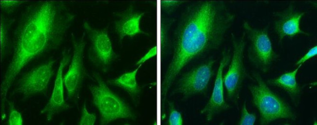 Calnexin Antibody in Immunocytochemistry (ICC/IF)