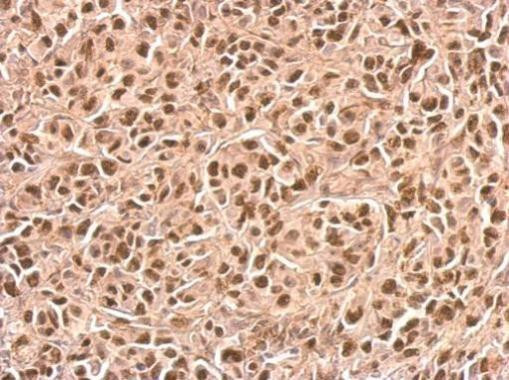 p21 Antibody in Immunohistochemistry (Paraffin) (IHC (P))