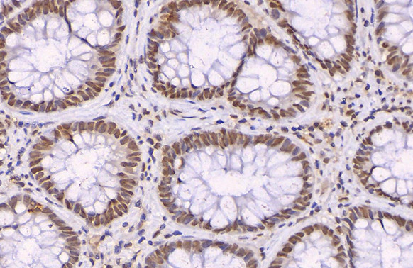 p21 Antibody in Immunohistochemistry (Paraffin) (IHC (P))