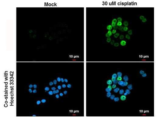 p21 Antibody in Immunocytochemistry (ICC/IF)