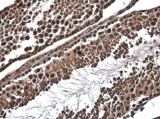 SMAD4 Antibody in Immunohistochemistry (Paraffin) (IHC (P))