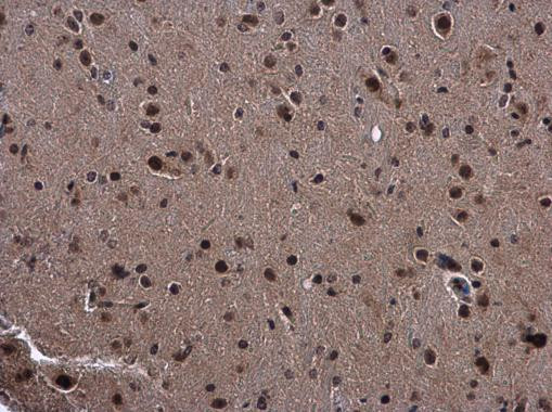 SMAD4 Antibody in Immunohistochemistry (Paraffin) (IHC (P))