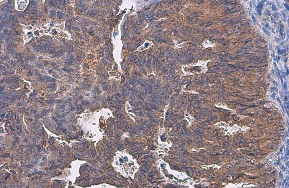 TRADD Antibody in Immunohistochemistry (Paraffin) (IHC (P))